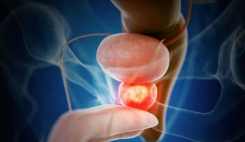 kronik prostatit nedir