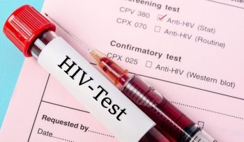 pozitif hiv virüsü