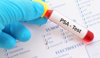 psa testi