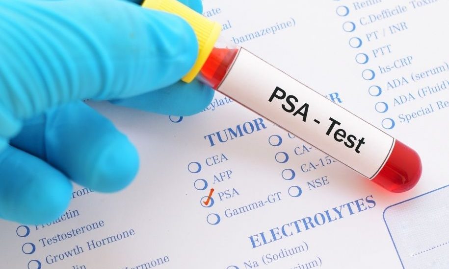 psa testi