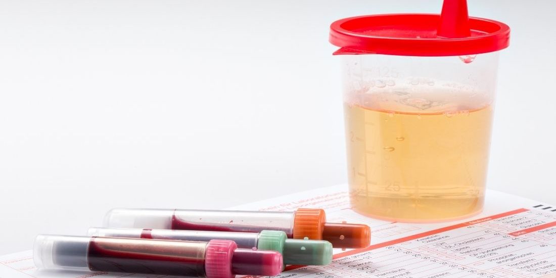 idrardan kan gelmesi