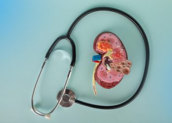 AA - Böbrek Kisti ile Böbrek Taşı Farkı Nasıl Anlaşılır