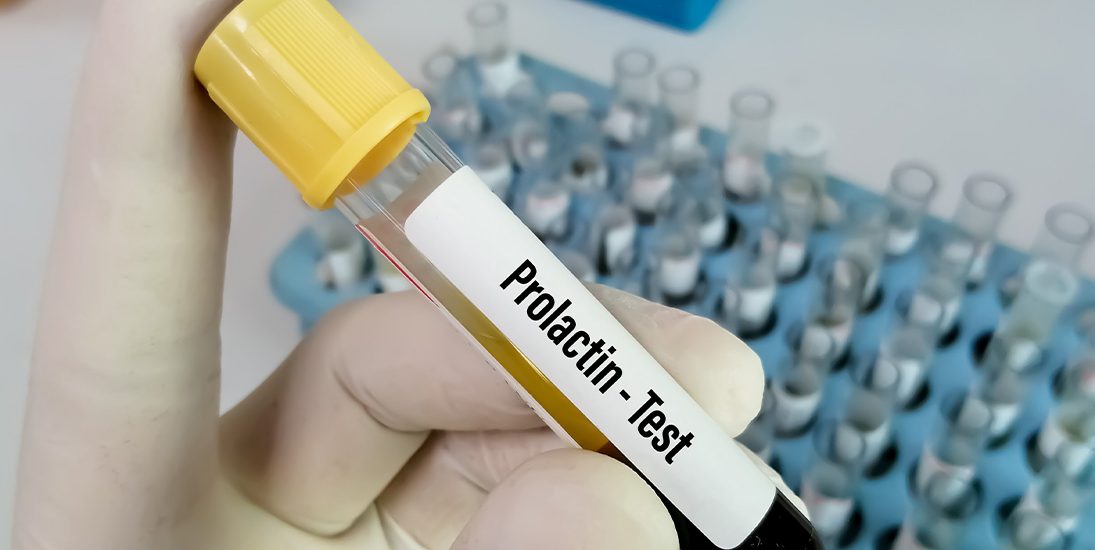prolaktin yüksekliği